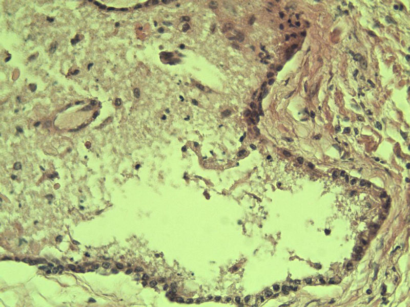 前列腺有问题没?图19
