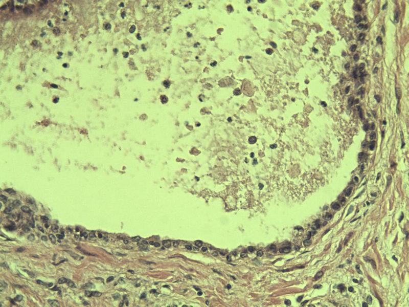 前列腺有问题没?图20