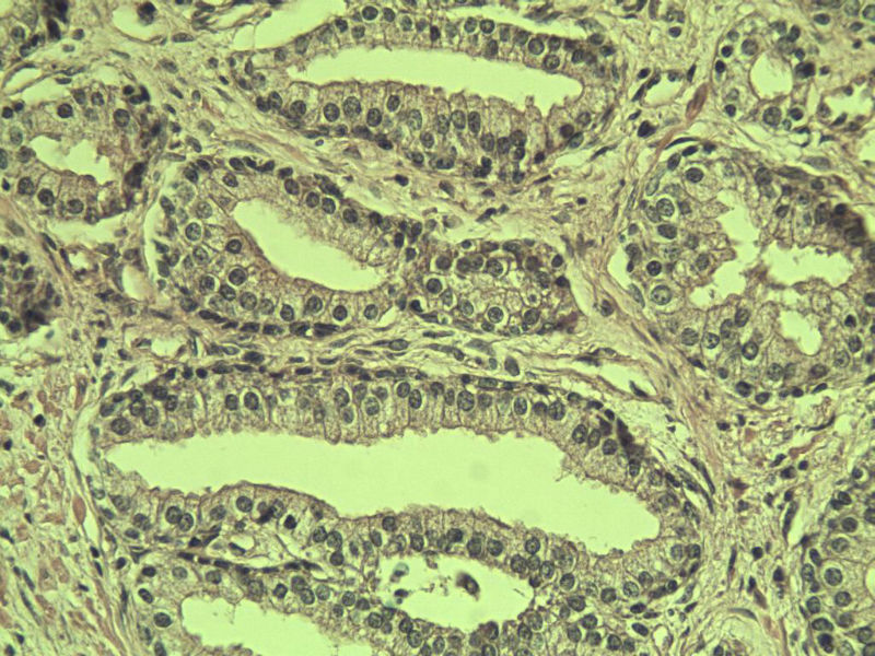 前列腺有问题没?图21