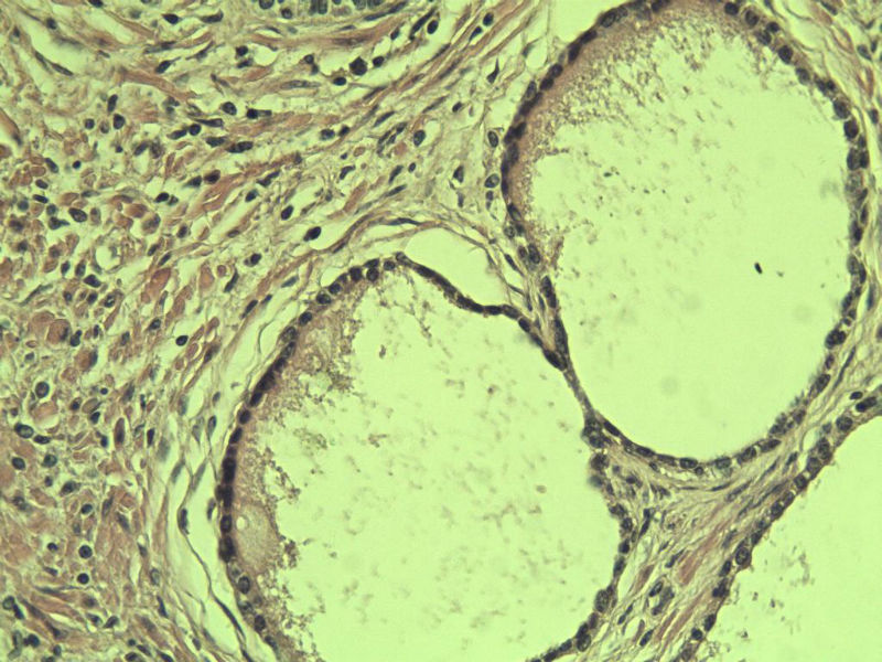前列腺有问题没?图22