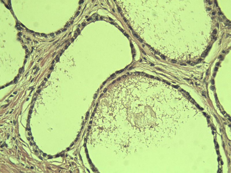 前列腺有问题没?图23