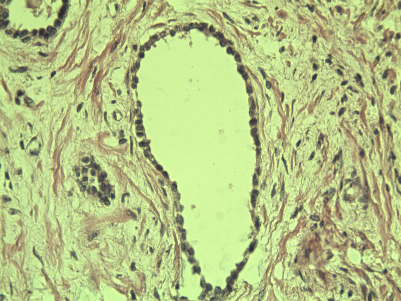 前列腺有问题没?图24