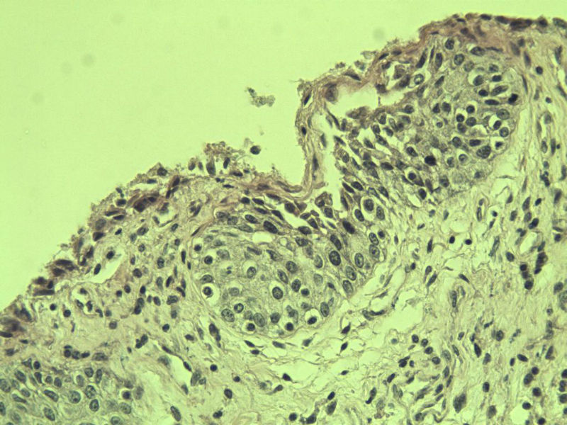 前列腺有问题没?图25