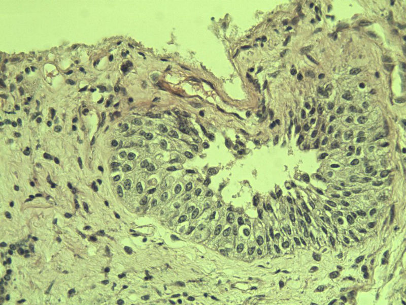 前列腺有问题没?图26
