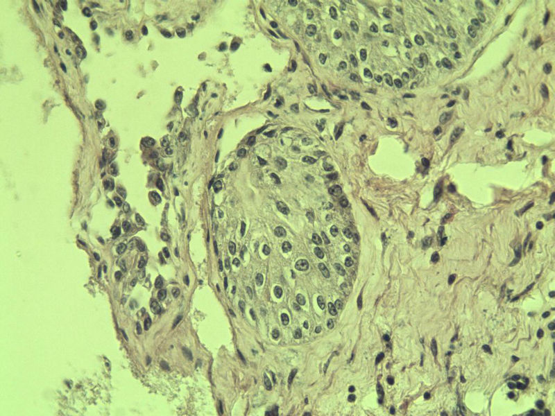 前列腺有问题没?图27