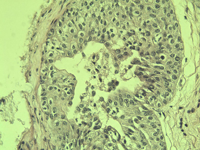 前列腺有问题没?图28