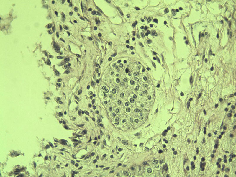 前列腺有问题没?图29