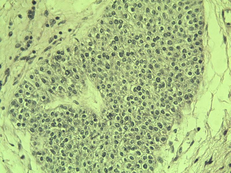 前列腺有问题没?图30