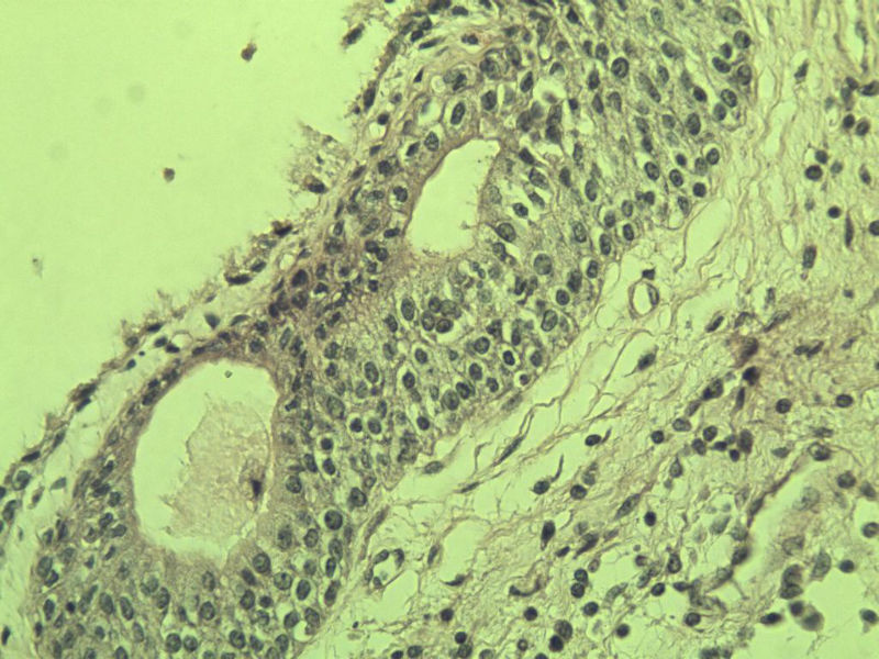 前列腺有问题没?图31