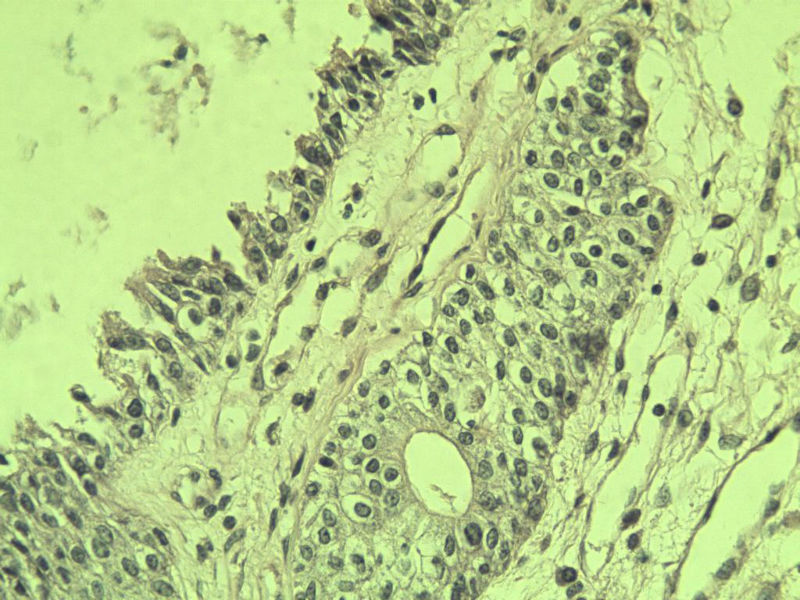 前列腺有问题没?图32