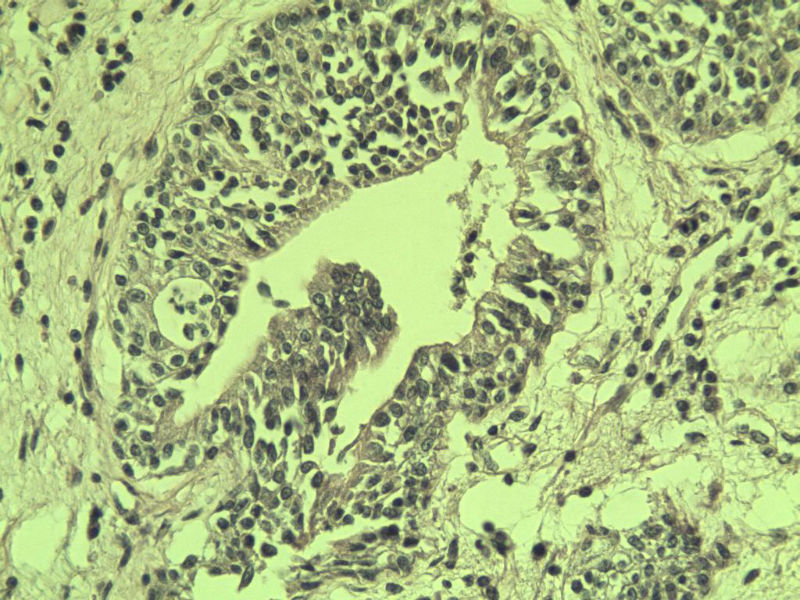 前列腺有问题没?图33