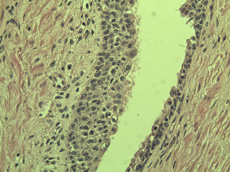 前列腺有问题没?图34