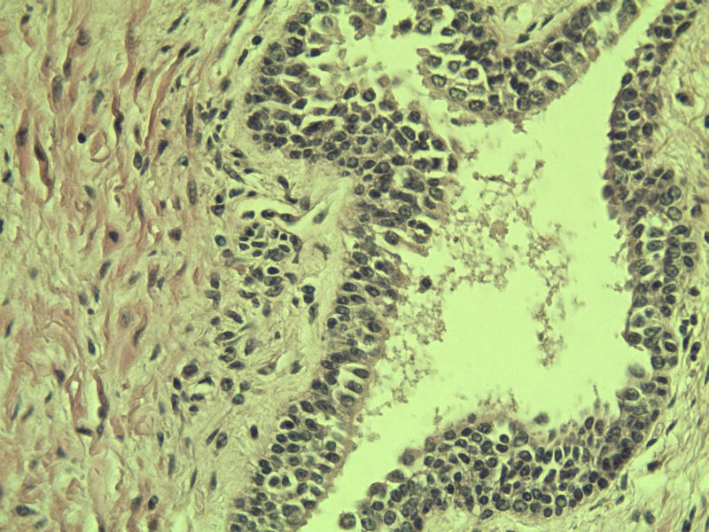 前列腺有问题没?图35