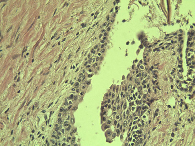 前列腺有问题没?图36