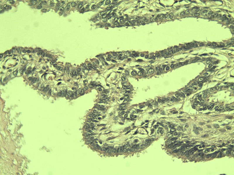 阑尾图8 阑尾图8