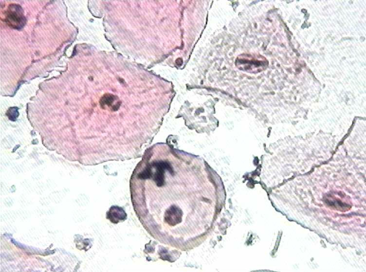 大家看看这是不是挖空细胞图2