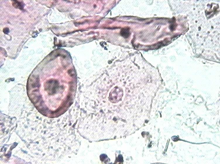 大家看看这是不是挖空细胞图3