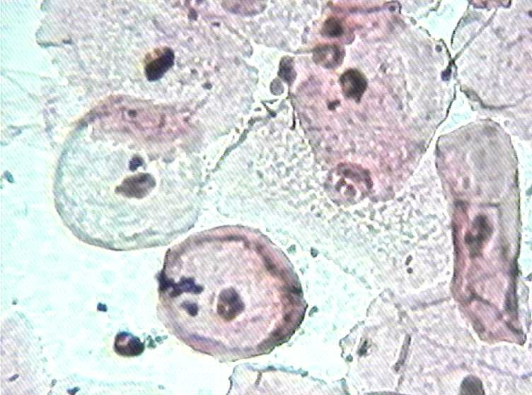 大家看看这是不是挖空细胞图4