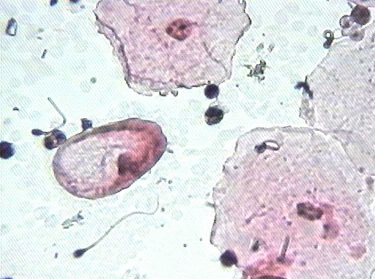 大家看看这是不是挖空细胞图7