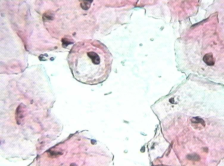 大家看看这是不是挖空细胞图8