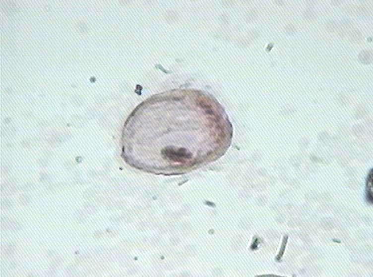 大家看看这是不是挖空细胞图9