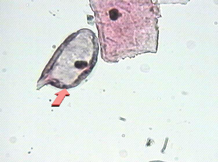 大家看看这是不是挖空细胞图10