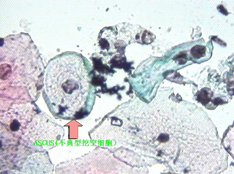 大家看看这个病人有什么细胞？图1