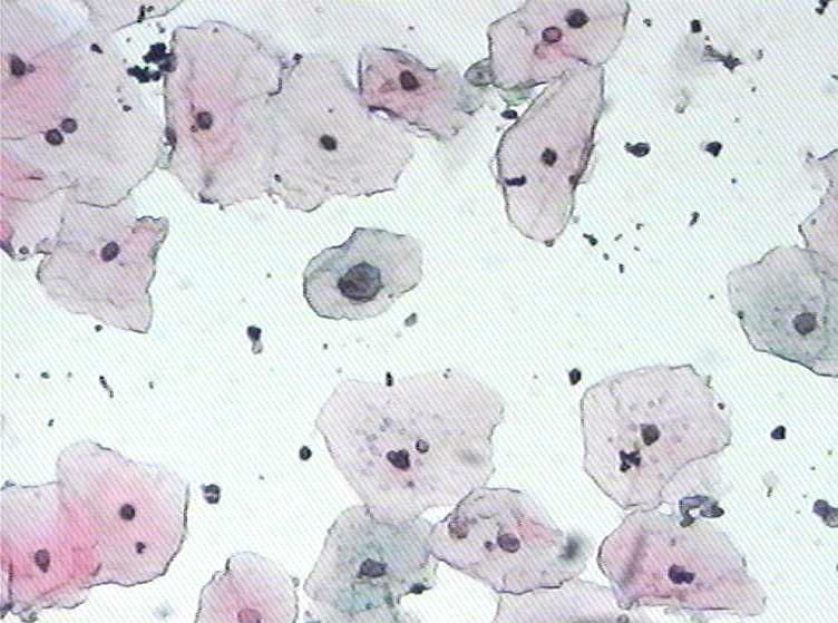 大家看看这个病人有什么细胞？图3