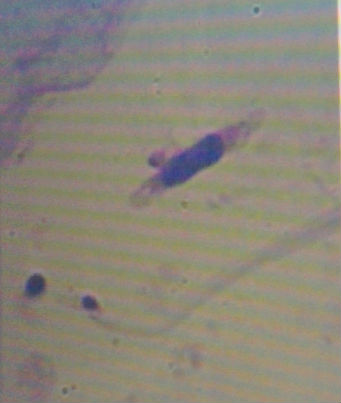 请各位老师帮我看看这个TCT是什么细胞图7