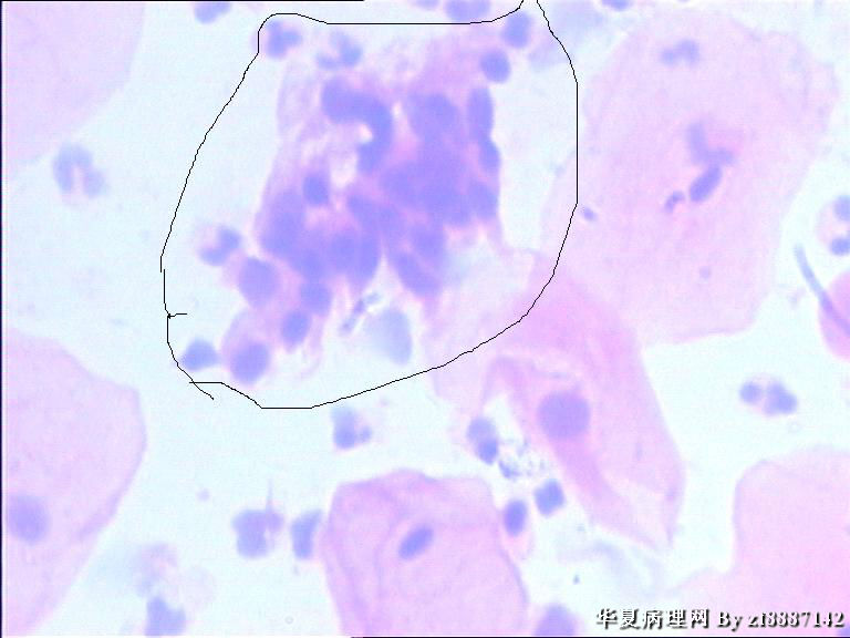 请教各位老师能否讲解一下这样腺还是鳞图2