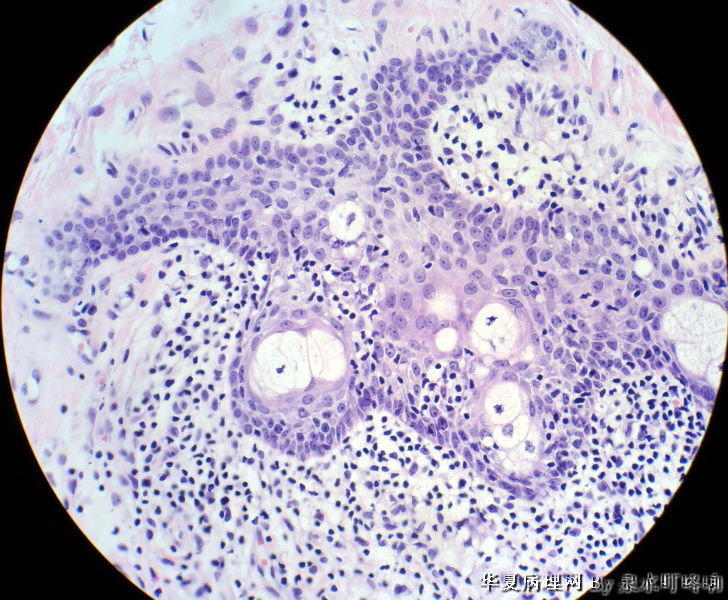 左耳后肿物图17