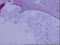 输卵管浆膜面粟粒大小白色囊泡。图3