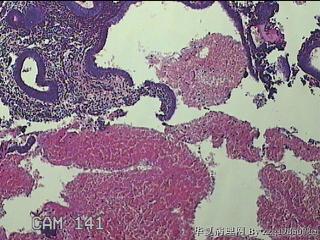 宫腔组织图40