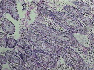 横结肠粘膜图2