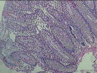 横结肠粘膜图5