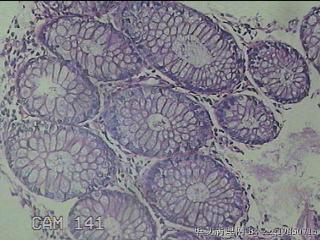 横结肠粘膜图18