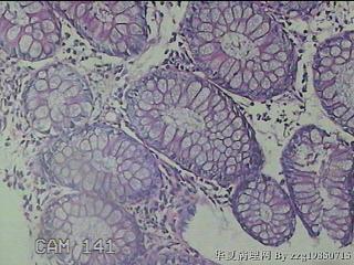 横结肠粘膜图19