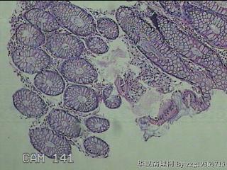 横结肠粘膜图3