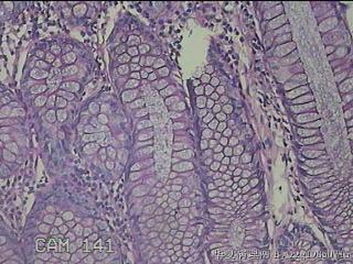 横结肠粘膜图10