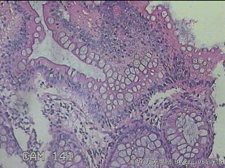 横结肠粘膜图8