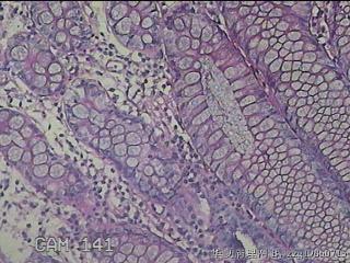 横结肠粘膜图12
