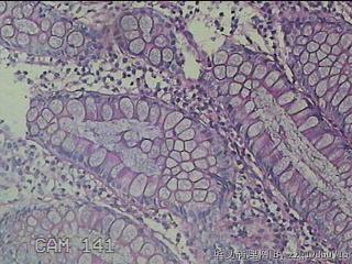 横结肠粘膜图16