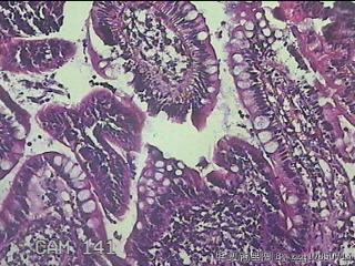 回肠末端粘膜图16