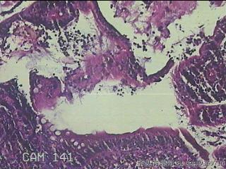 回肠末端粘膜图26