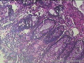 直乙结肠粘膜图35