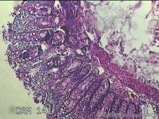 直乙结肠粘膜图26