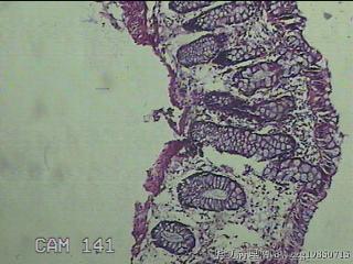 直乙结肠粘膜图6