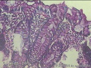 直乙结肠粘膜图40
