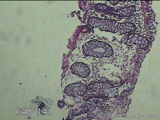 直乙结肠粘膜图7