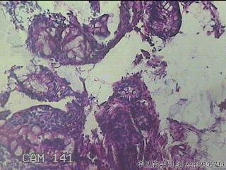 直乙结肠粘膜图37